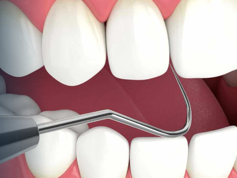 full-mouth-reconstruction-advanced-smile-restoration