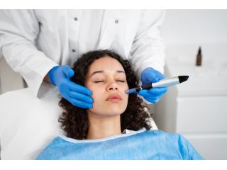 best-microneedling-for-acne-scars-morgan-hill-small-0