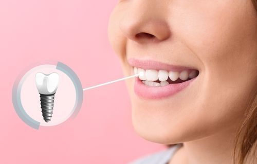 top-clinics-offering-best-seattle-dental-implants-services-big-0