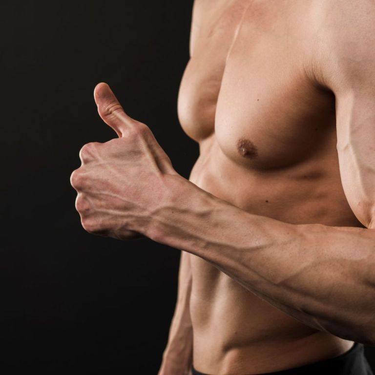 bicep-and-tricep-implants-enhance-arm-definition-big-0