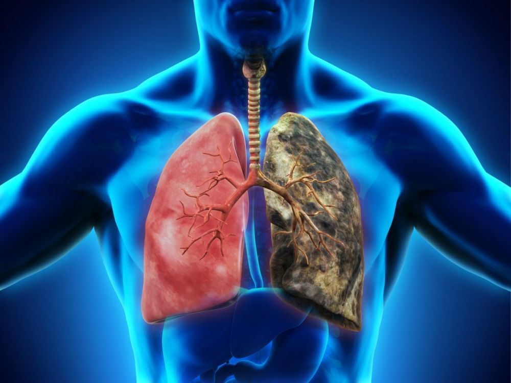 non-small-cell-lung-cancer-specialists-big-0