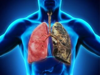 non-small-cell-lung-cancer-specialists-small-0