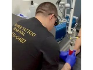 professional-toenail-fungus-treatments-in-mckinney-small-0
