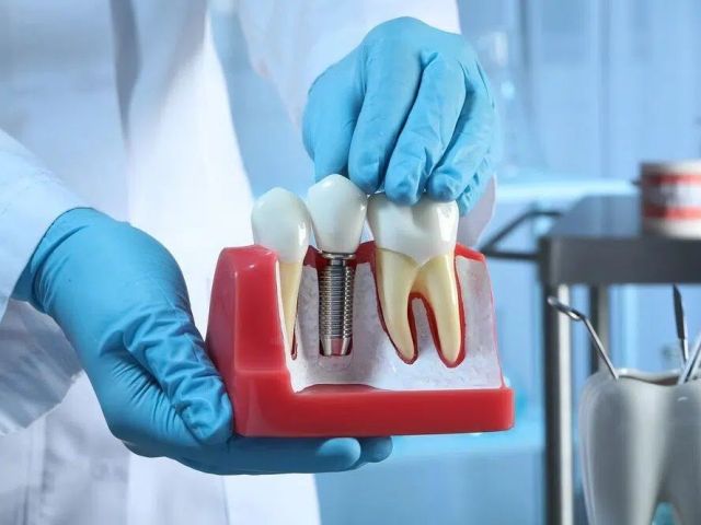 best-dental-implants-brisbane-hashtag-dentist