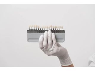 porcelain-veneers-brisbane-hashtag-dentist-small-0