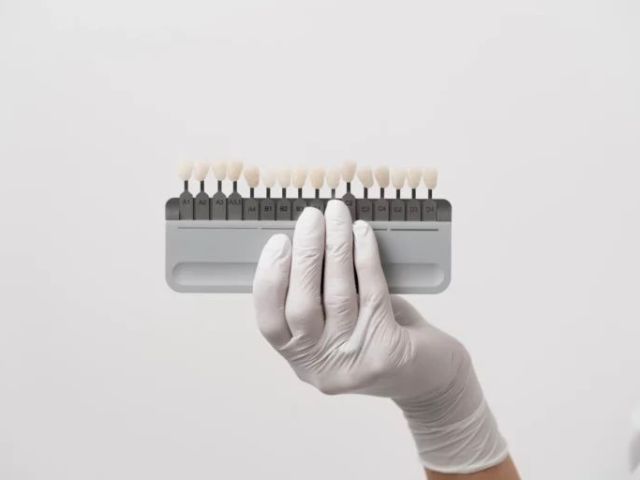 porcelain-veneers-brisbane-hashtag-dentist