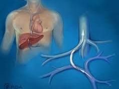 tips-procedure-radiology-for-liver-management