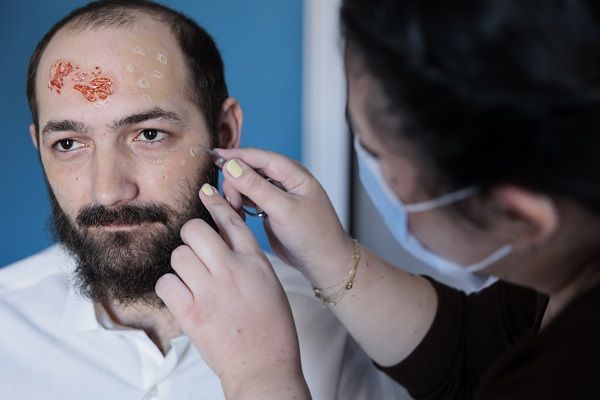 reliable-wart-infection-care-treatment-in-nyc-big-0