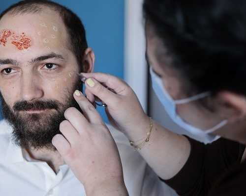reliable-wart-infection-care-treatment-in-nyc