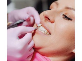 transform-your-smile-with-cosmetic-dentistry-in-perris-small-0