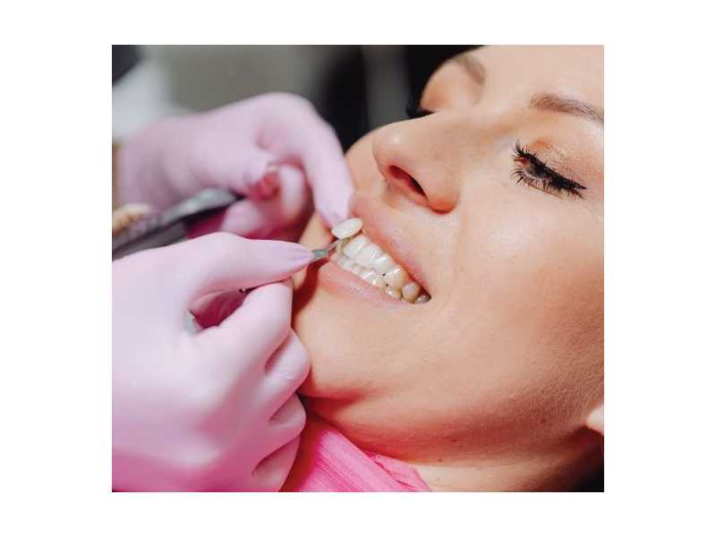 transform-your-smile-with-cosmetic-dentistry-in-perris-small-0