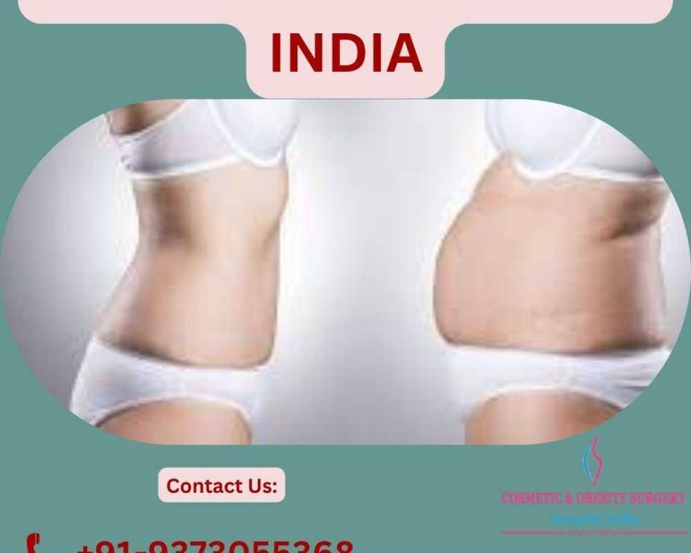 mommy-makeover-in-india