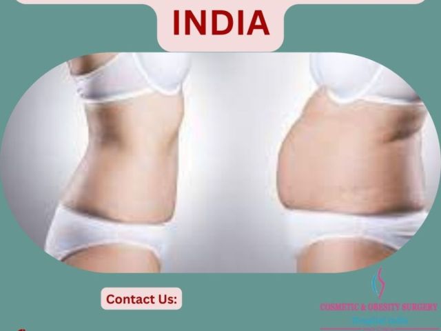 mommy-makeover-in-india