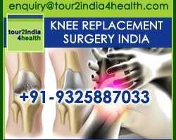 knee-replacement-surgery-in-india