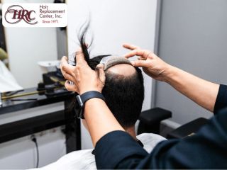 undetectable-hair-pieces-premium-quality-solutions-small-0