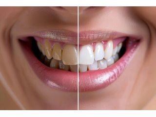 transform-your-smile-with-the-latest-dental-innovations-small-0