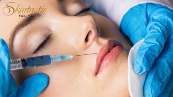 lip-fillers-riverside-for-natural-beauty-enhancement-big-0