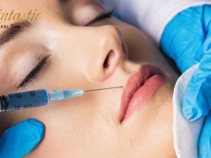 lip-fillers-riverside-for-natural-beauty-enhancement