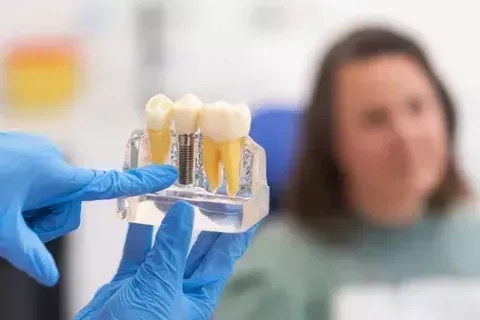wilmington-dental-implants-specialist-expert-affordable-care-big-0