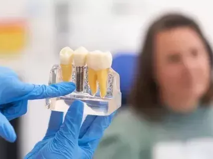 wilmington-dental-implants-specialist-expert-affordable-care
