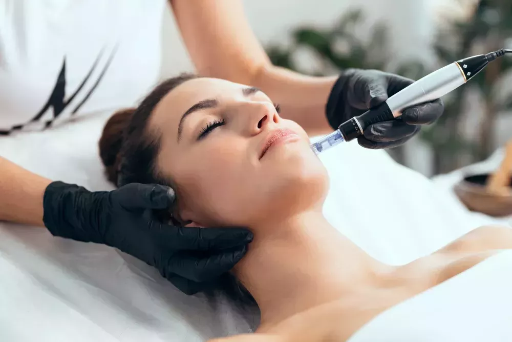microneedling-tampa-for-smooth-youthful-skin-big-0