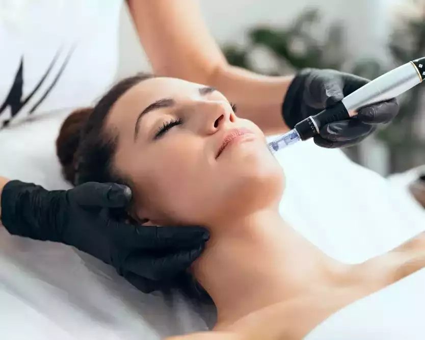 microneedling-tampa-for-smooth-youthful-skin