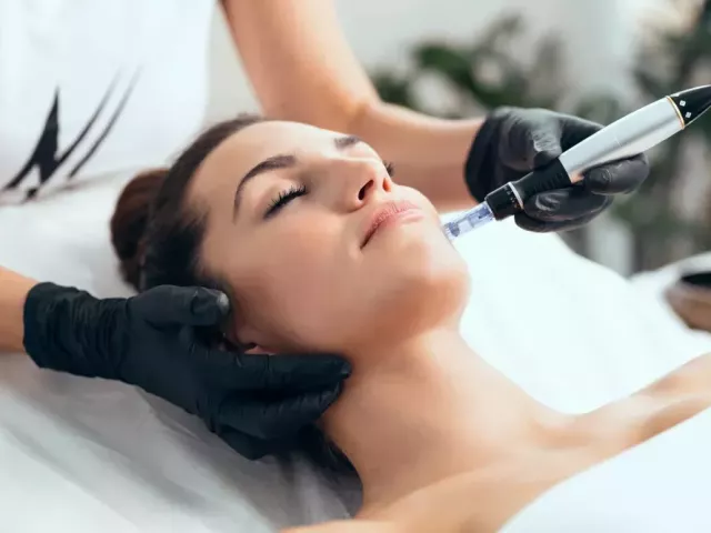 microneedling-tampa-for-smooth-youthful-skin