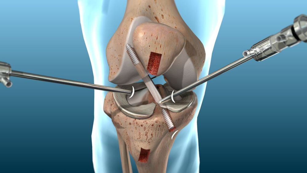 best-orthopaedic-hospital-in-bilaspur-big-0