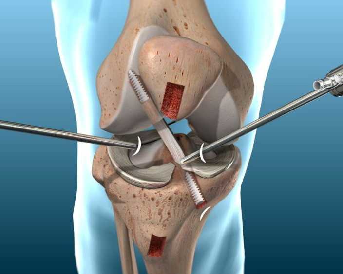 best-orthopaedic-hospital-in-bilaspur