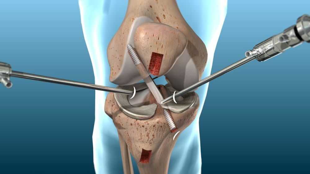 best-orthopaedic-hospital-in-bilaspur-big-0