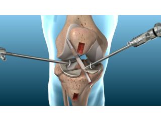 best-orthopaedic-hospital-in-bilaspur-small-0