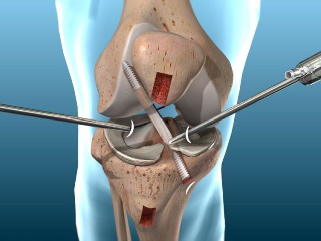 best-orthopaedic-hospital-in-bilaspur