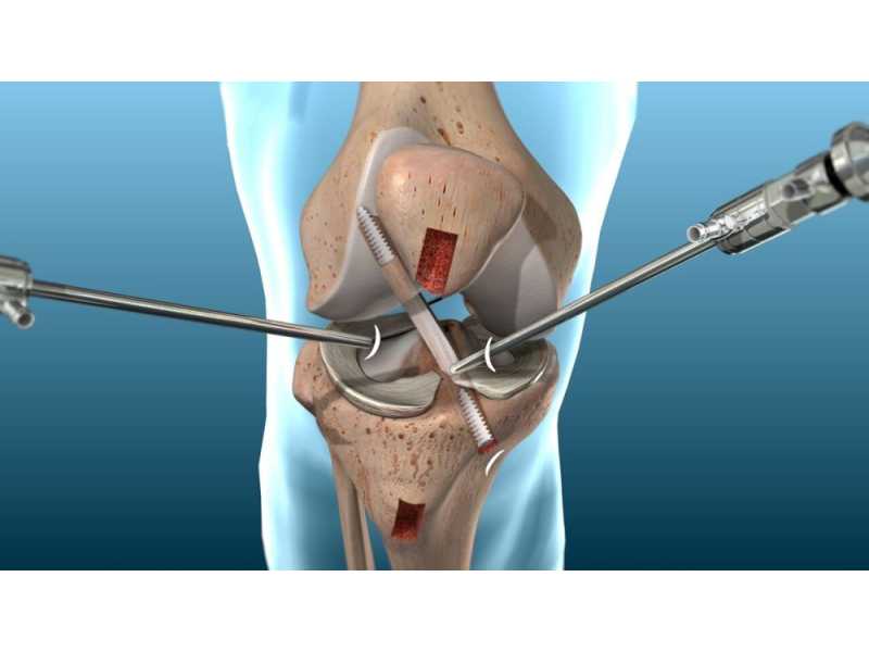 best-orthopaedic-hospital-in-bilaspur-small-0