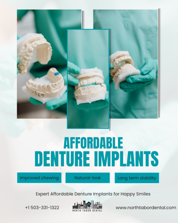 where-to-get-affordable-denture-implants-in-portland-big-0