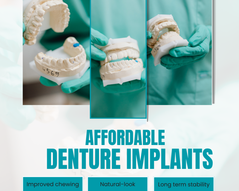 where-to-get-affordable-denture-implants-in-portland