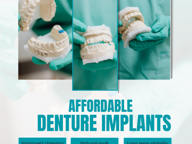 where-to-get-affordable-denture-implants-in-portland