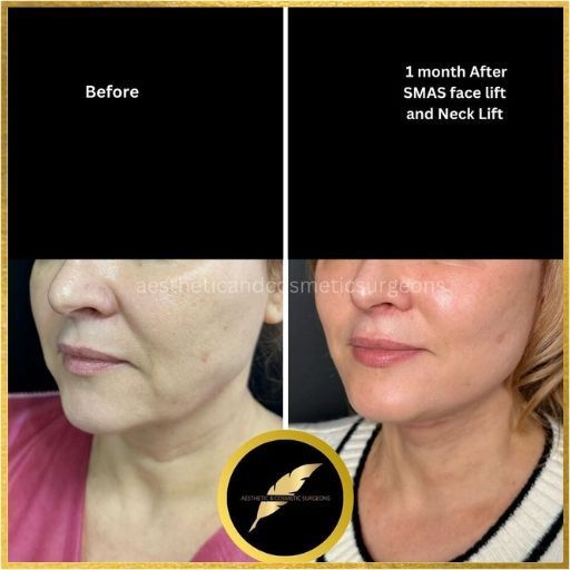 aesthetic-cosmetic-surgeon-in-los-angeles-dr-saurabh-jain-big-2