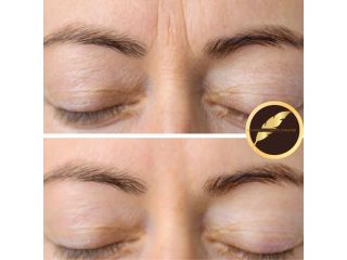 aesthetic-cosmetic-surgeon-in-los-angeles-dr-saurabh-jain-small-1