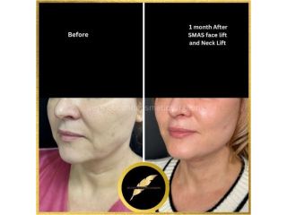 aesthetic-cosmetic-surgeon-in-los-angeles-dr-saurabh-jain-small-2