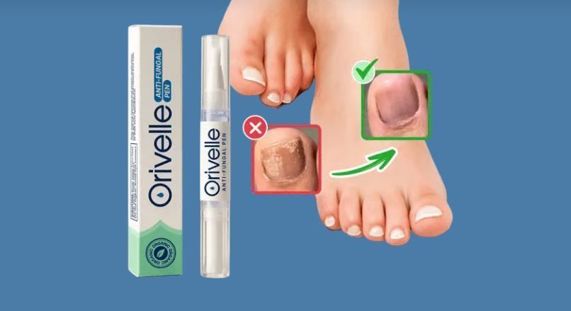 orvelle-the-advanced-anti-fungal-nail-pen-for-healthier-nails-big-0