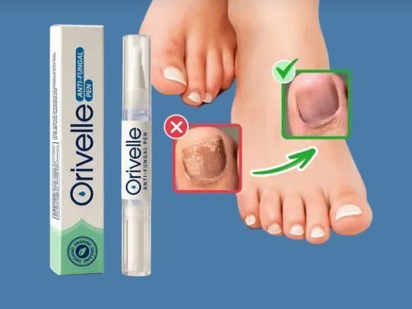 orvelle-the-advanced-anti-fungal-nail-pen-for-healthier-nails