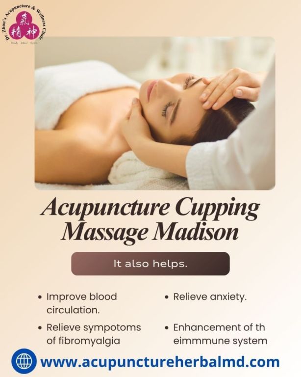acupuncture-cupping-massage-madison-big-0