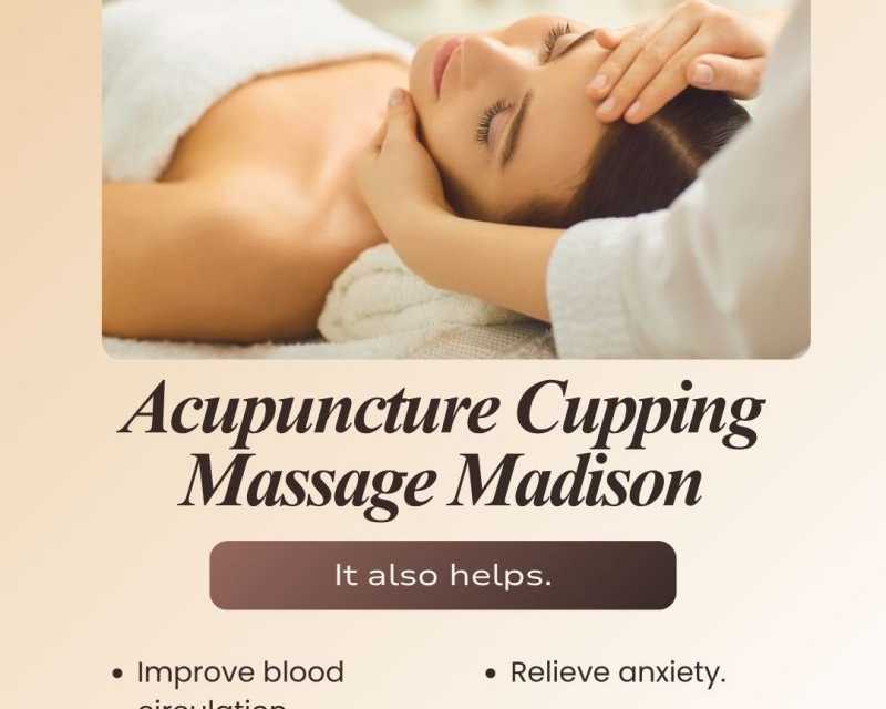 acupuncture-cupping-massage-madison