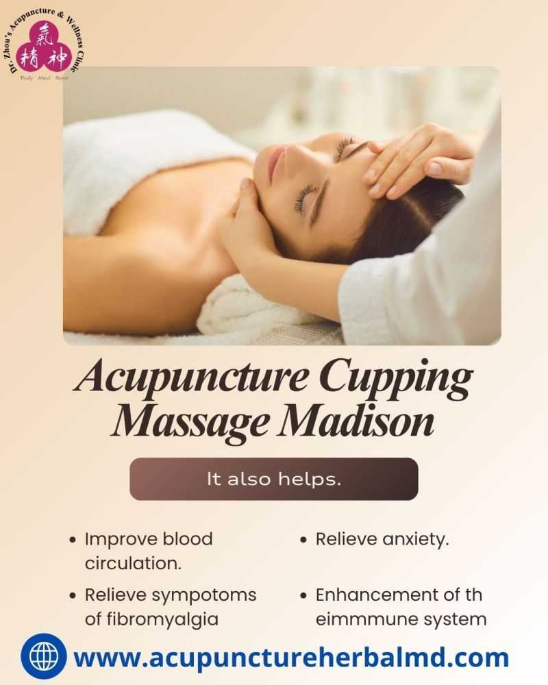 acupuncture-cupping-massage-madison-big-0