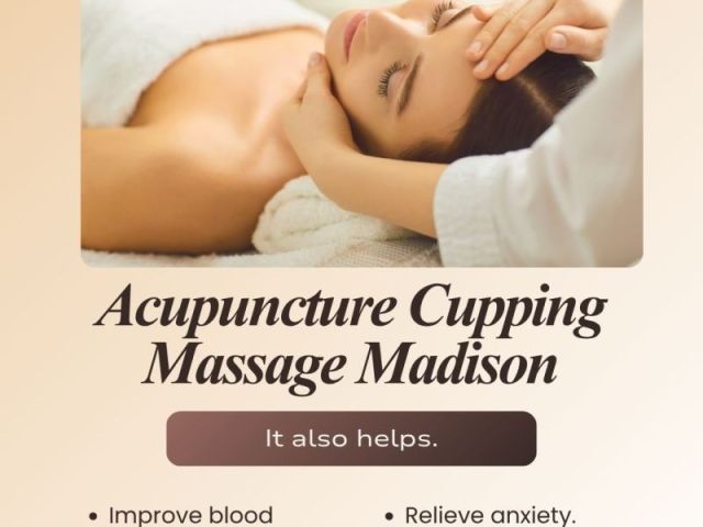 acupuncture-cupping-massage-madison