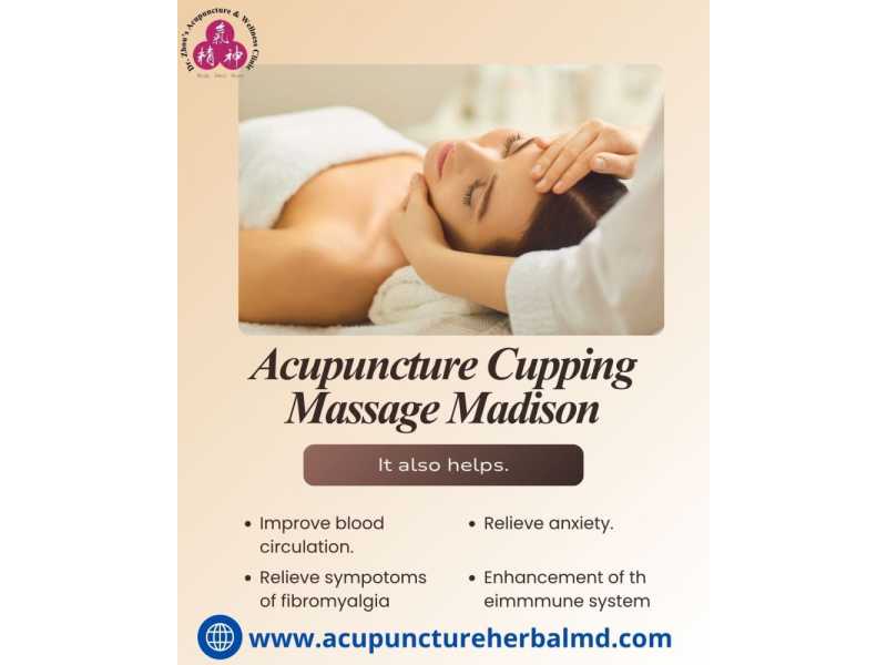 acupuncture-cupping-massage-madison-small-0