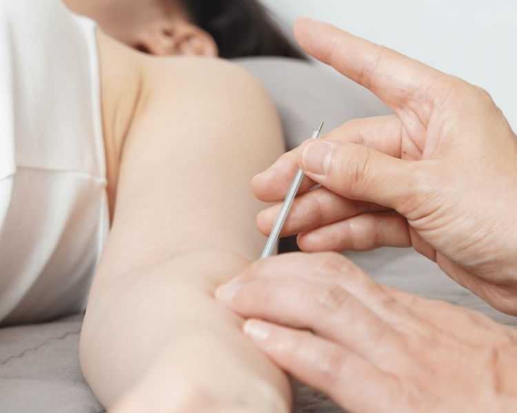 acupuncturist-upper-west-side-nyc