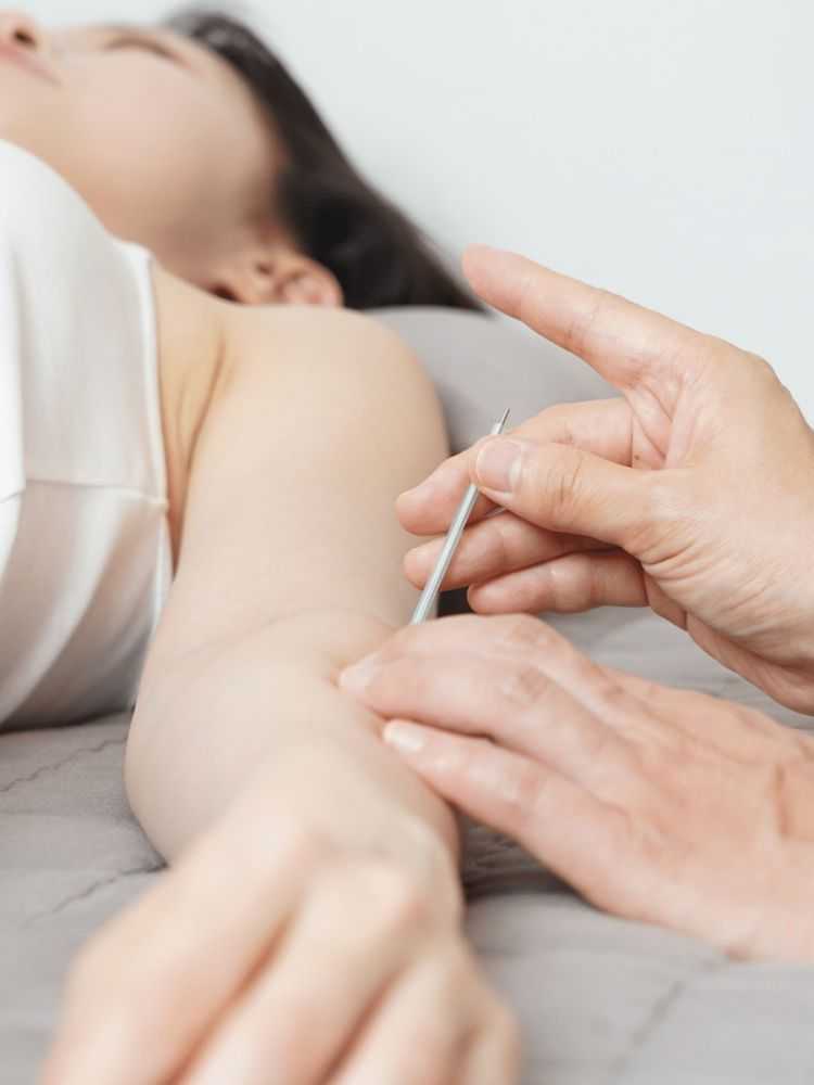 acupuncturist-upper-west-side-nyc-big-0