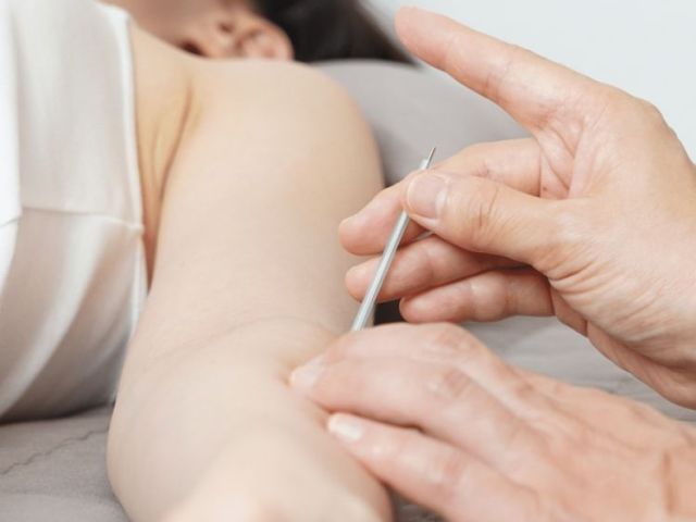 acupuncturist-upper-west-side-nyc