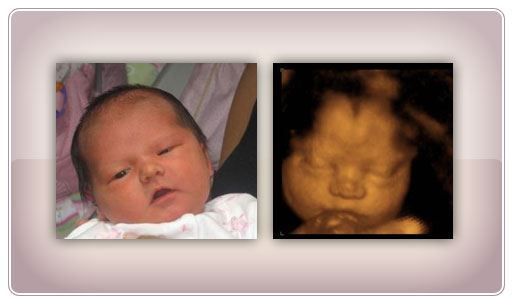early-baby-insights-dna-gender-test-services-in-anaheim-big-0